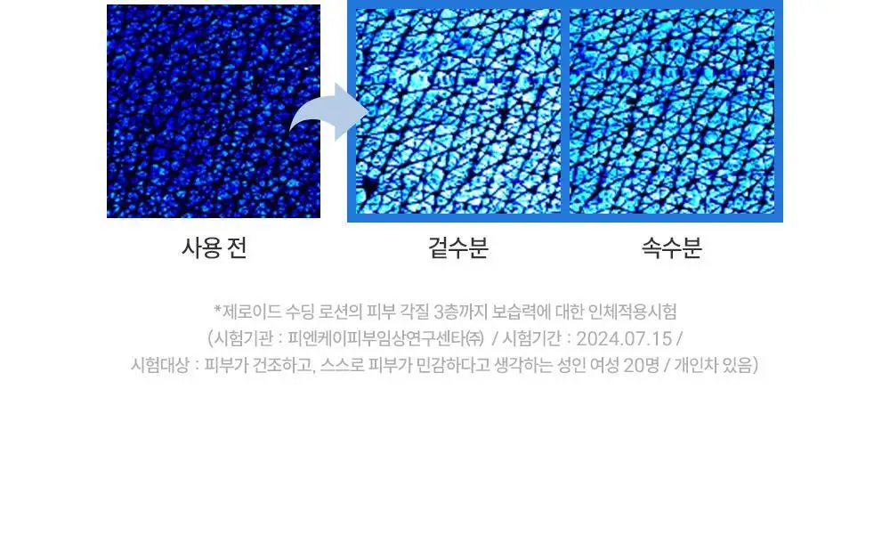 [5월 올영픽] 제로이드 수딩 로션 160ml 기획 (+크림 25ml+데일리 선크림 10ml) 상세페이지 24